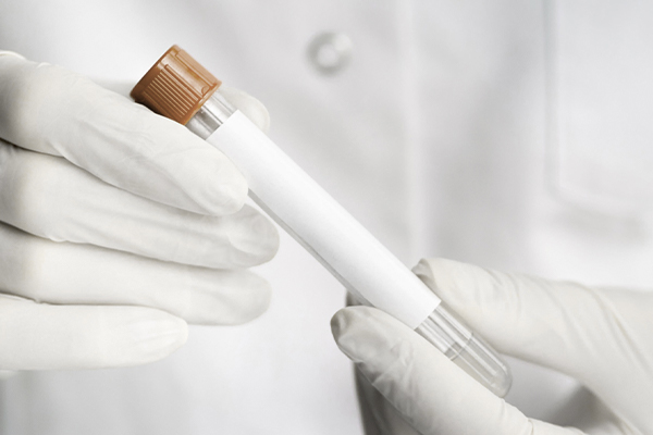 Servicio analisis rapidos farmacia cientoocoho